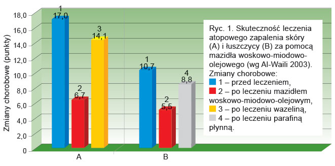 Ryc. 1. Skuteczność leczenia atopowego zapalenia skóry (A) i łuszczycy (B) za pomocą mazidła woskowo-miodowo-olejowego (wg Al-Waili 2003).